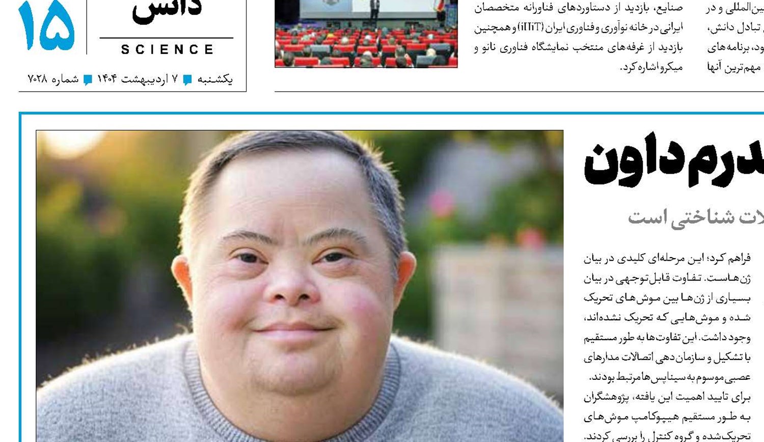 امیدی تازه برای مقابله با سندرم داون